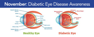 November is Diabetic Eye Disease Awareness Month